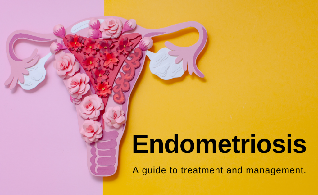 Endometriosis a guide to treatment and management Wollongong